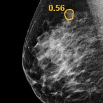 European Radiology - Interactive CAD